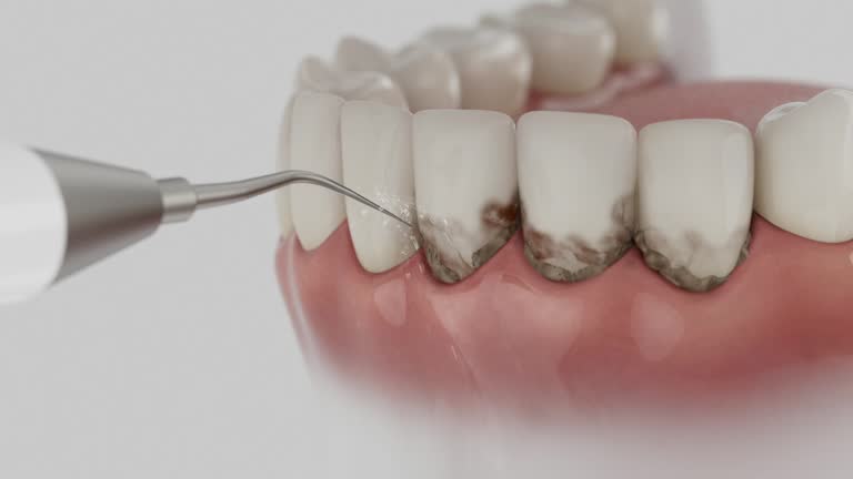 Trusted Teeth Cleaning And Checkup service in Selmont-West Selmont, AL - Dentist Open Now
